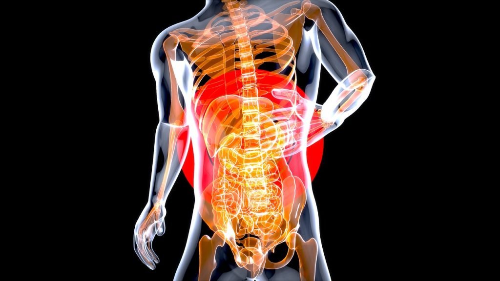 kidney stones and gut health